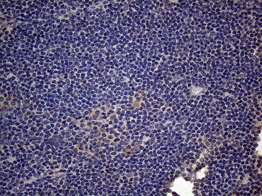Monoclonal Mouse anti-Human CSF2 / GM-CSF Antibody (clone OTI10G3, aa18-144, IHC, WB)