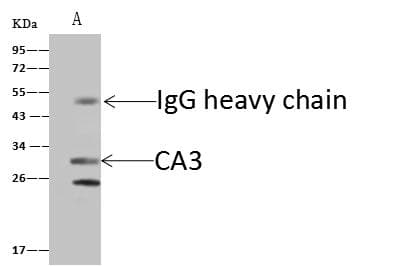 CA3 / Carbonic Anhydrase III Antibody