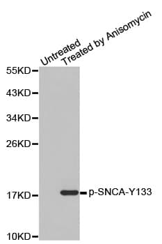 SNCA / Alpha-Synuclein Antibody (phospho-Tyr133)
