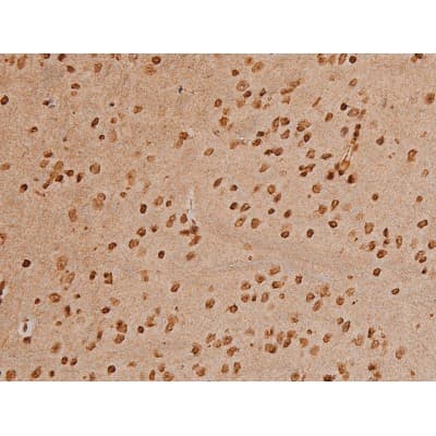 Polyclonal Rabbit anti-Human EZR / Ezrin Antibody (phospho-Tyr353, IF, WB)
