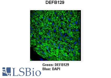 Polyclonal Rabbit anti-Human DEFB129 Antibody (aa108-157, IHC, WB)