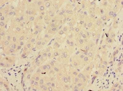 PPM1M Antibody