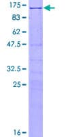 Human SRPK1 Protein (Recombinant GST)