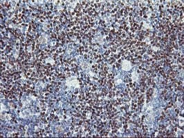 PDSS2 / DLP1 Antibody (clone OTI1D6)