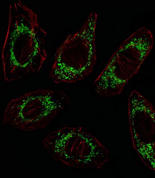 OAT Antibody (aa27-55)