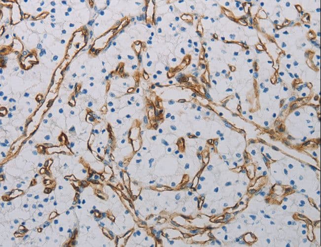 PECAM-1 / CD31 Antibody