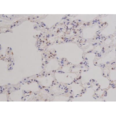 Polyclonal Rabbit anti-Human BCL2L1 / BCL-XL Antibody (phospho-Thr47, IHC, IF, WB)