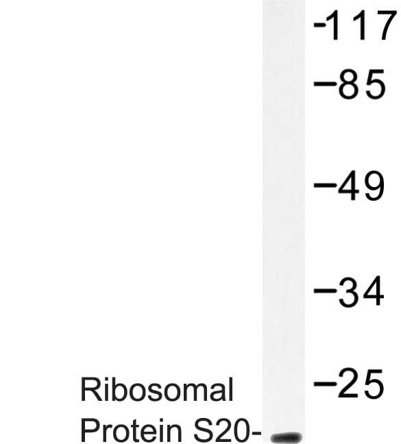 RPS20 / Ribosomal Protein S20 Antibody (Lys67)