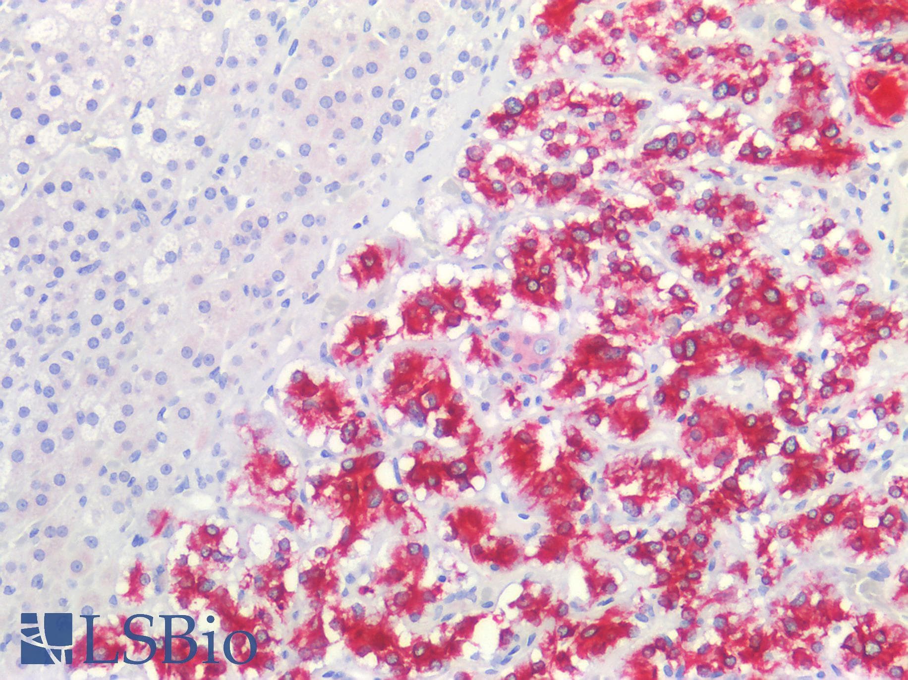 IHC-plus™ GRIN1 / NMDAR1 Antibody