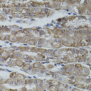 SHH / Sonic Hedgehog Antibody