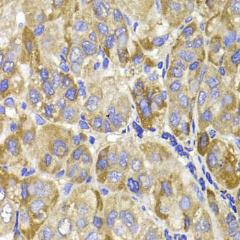 Polyclonal Rabbit anti-Human MAGED1 / NRAGE Antibody (IHC, IF, WB)