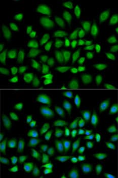 PDE4D Antibody