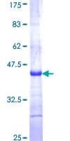 Human SPINLW1 / EPPIN Protein (Recombinant GST)