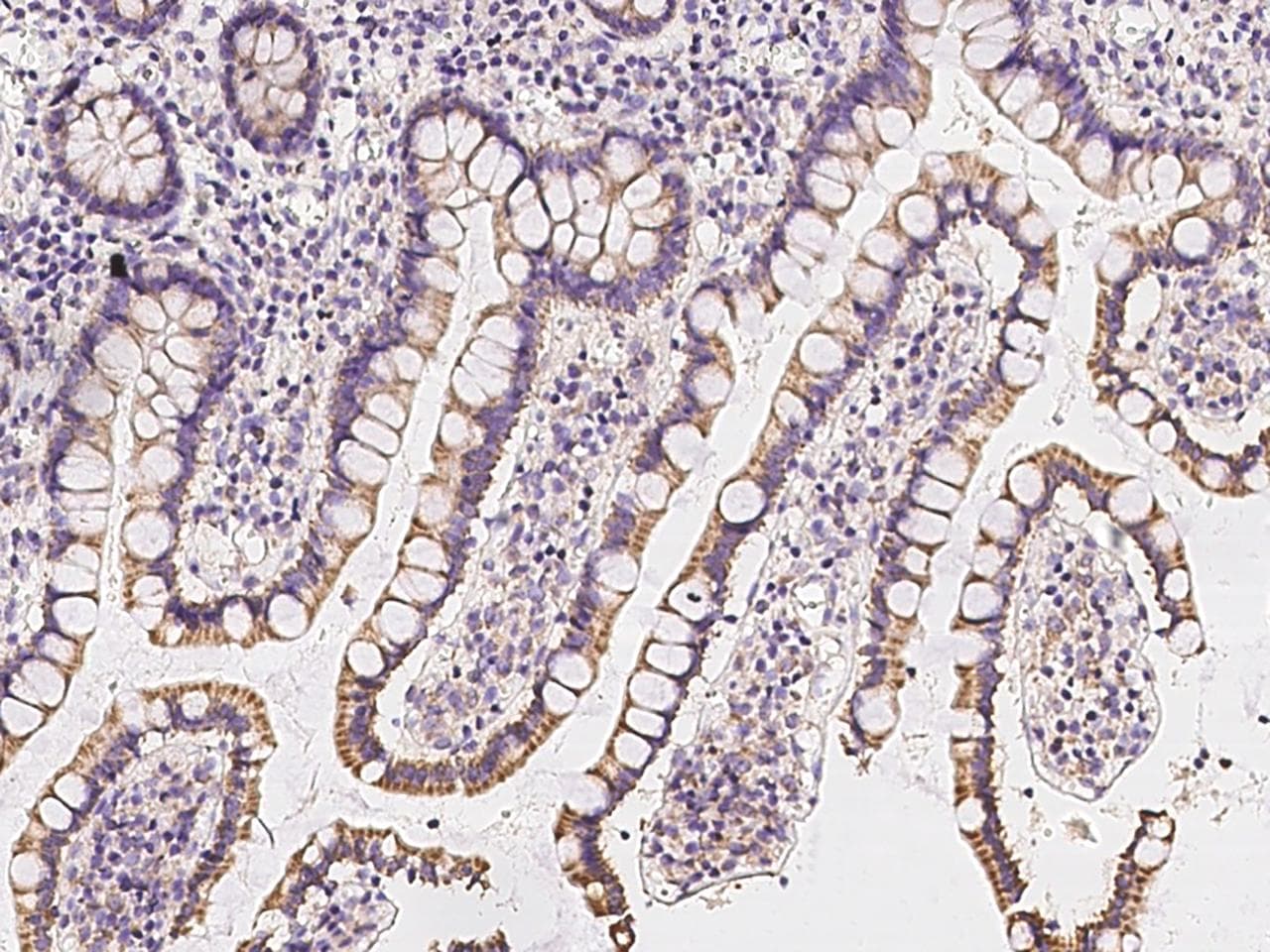 TCTN3 Antibody