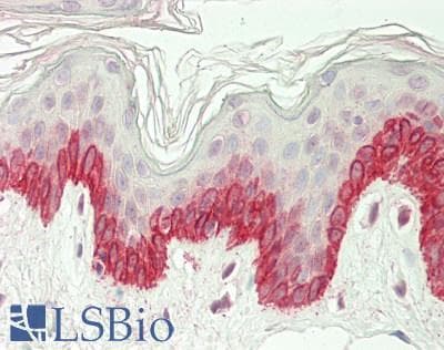 KAT5 / TIP60 Antibody (aa107-156)