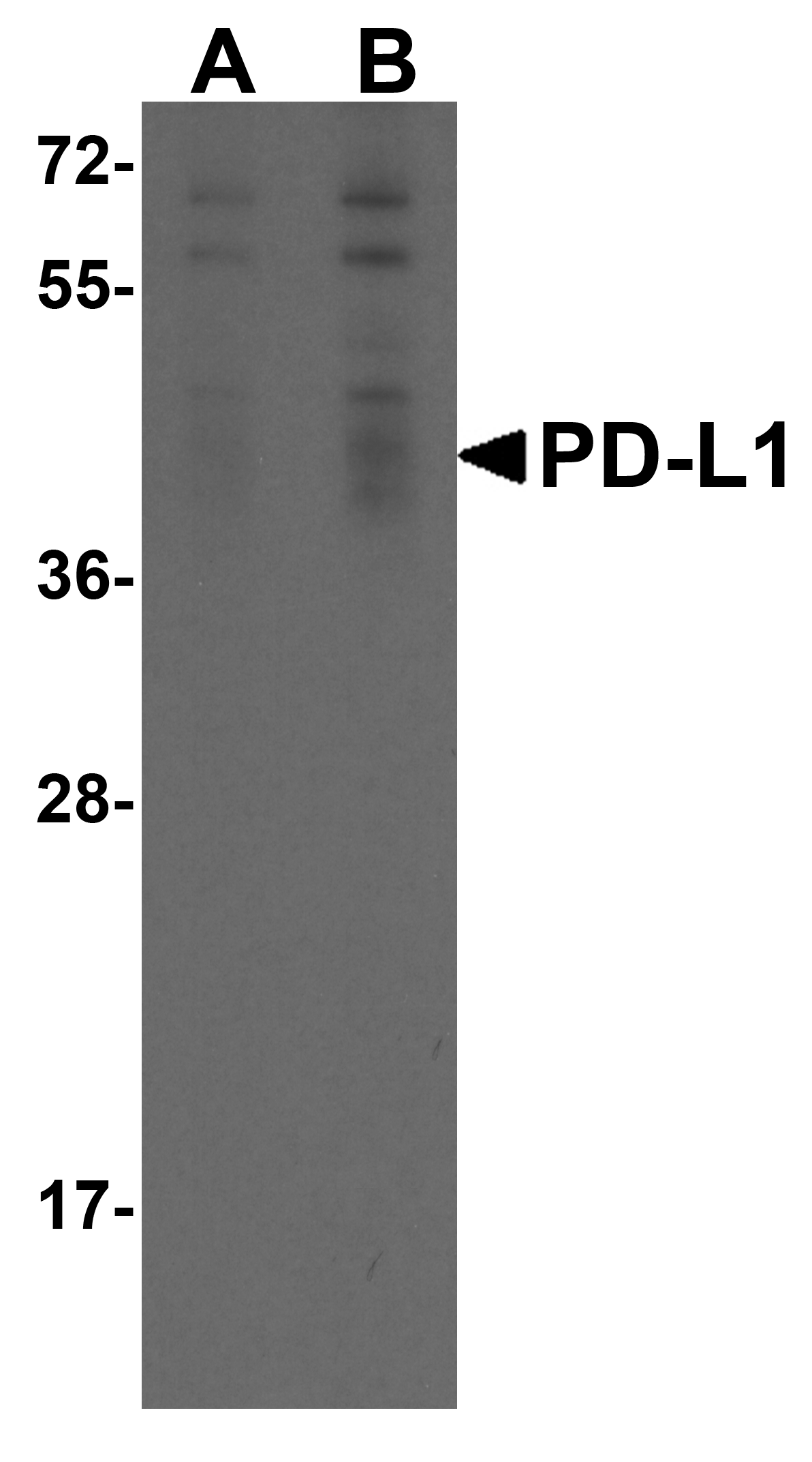 CD274 / B7-H1 / PD-L1 Antibody (clone 1D7)