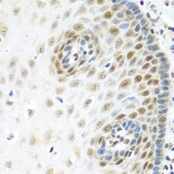 Polyclonal Rabbit anti-Human MDC1 Antibody (IHC, WB)