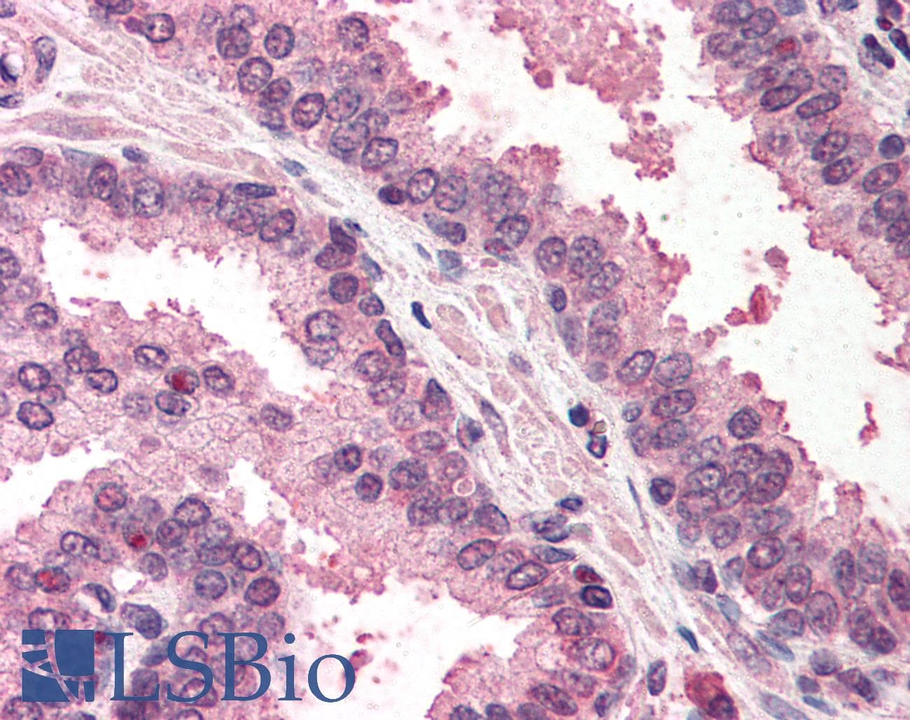 IHC-plus™ RAD23A / HHR23A Antibody (aa115-140)