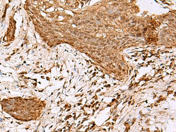 SAMSN1 Antibody