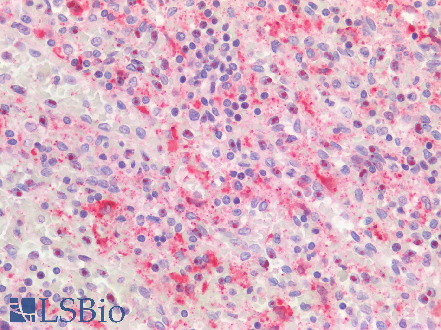 IHC-plus™ Polyclonal Rabbit anti-Human HPSE / Heparanase Antibody (IHC, WB)