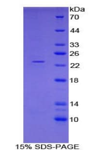 Pig FTH1 / Ferritin Heavy Chain Protein (Recombinant His)