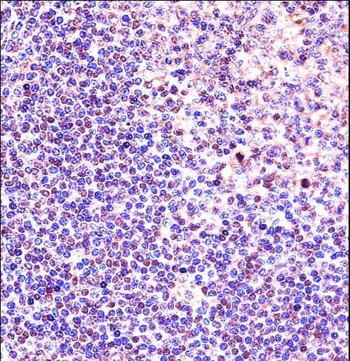 Polyclonal Rabbit anti-Human PHAP1 / ANP32A Antibody (aa133-162, IHC, WB)