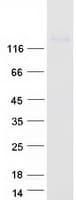 Human NCAM / CD56 Protein (Recombinant Myc-DDK (Flag))