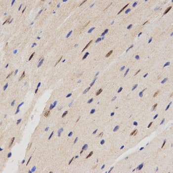 FAM160B2 / RAI16 Antibody