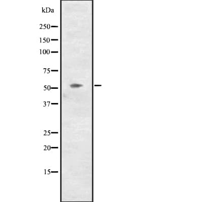 Polyclonal Rabbit anti-Human CCNL2 / Cyclin L2 Antibody (WB)