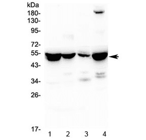 Polyclonal Rabbit anti-Human ASL / Argininosuccinate Lyase Antibody (IHC, WB)