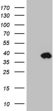 IGFBP1 Antibody (aa26-259, clone OTI1A8)