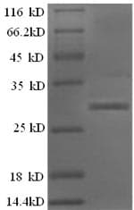 Human BTN3A1 / CD277 Protein (Recombinant 6His, N-terminus)