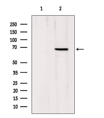 Polyclonal Rabbit anti-Human MTA3 Antibody (IHC, IF, WB)