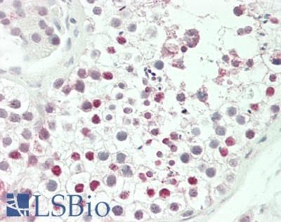 IHC-plus™ HOXA3 Antibody (aa413-440)