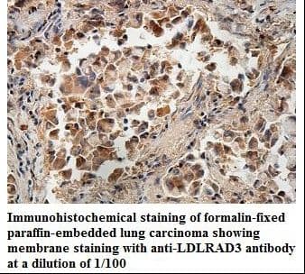 LDLRAD3 Antibody (aa34-161)