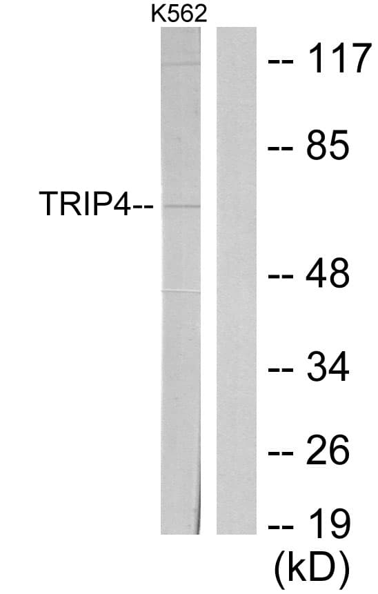TRIP4 / ASC-1 Antibody (aa81-130)