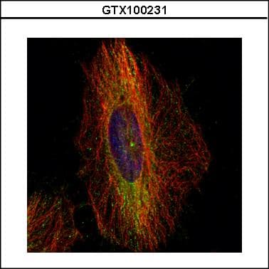 IHC-plus™ Polyclonal Rabbit anti-Human DCTN1 / Dynactin 1 Antibody (aa1216-1278, IHC, WB)