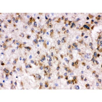 OTOF / Otoferlin Antibody (aa1831-1863)