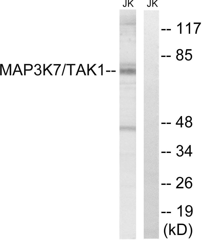Polyclonal Rabbit anti-Human MAP3K7 / TAK1 Antibody (p187, IHC, WB)