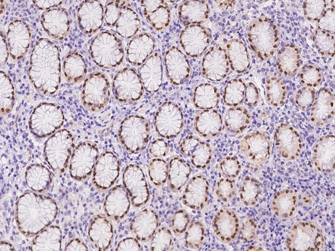 CASZ1 Antibody