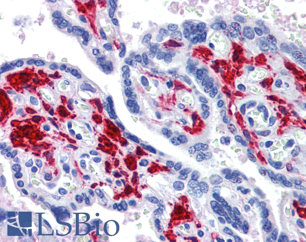 IHC-plus™ DDX58 / RIG-1 / RIG-I Antibody (C-Terminus)