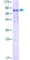 Human MAP2K5 / MEK5 Protein (Recombinant GST)