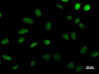 DDB2 Antibody (clone 2246C4a)