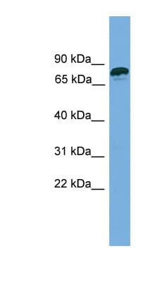 Polyclonal Rabbit anti-Human ZNF790 Antibody (aa107-156, WB)
