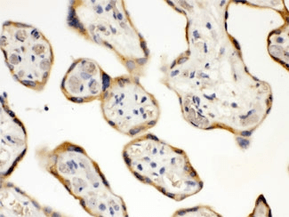 Polyclonal Rabbit anti-Human DDAH2 Antibody (IHC, WB)