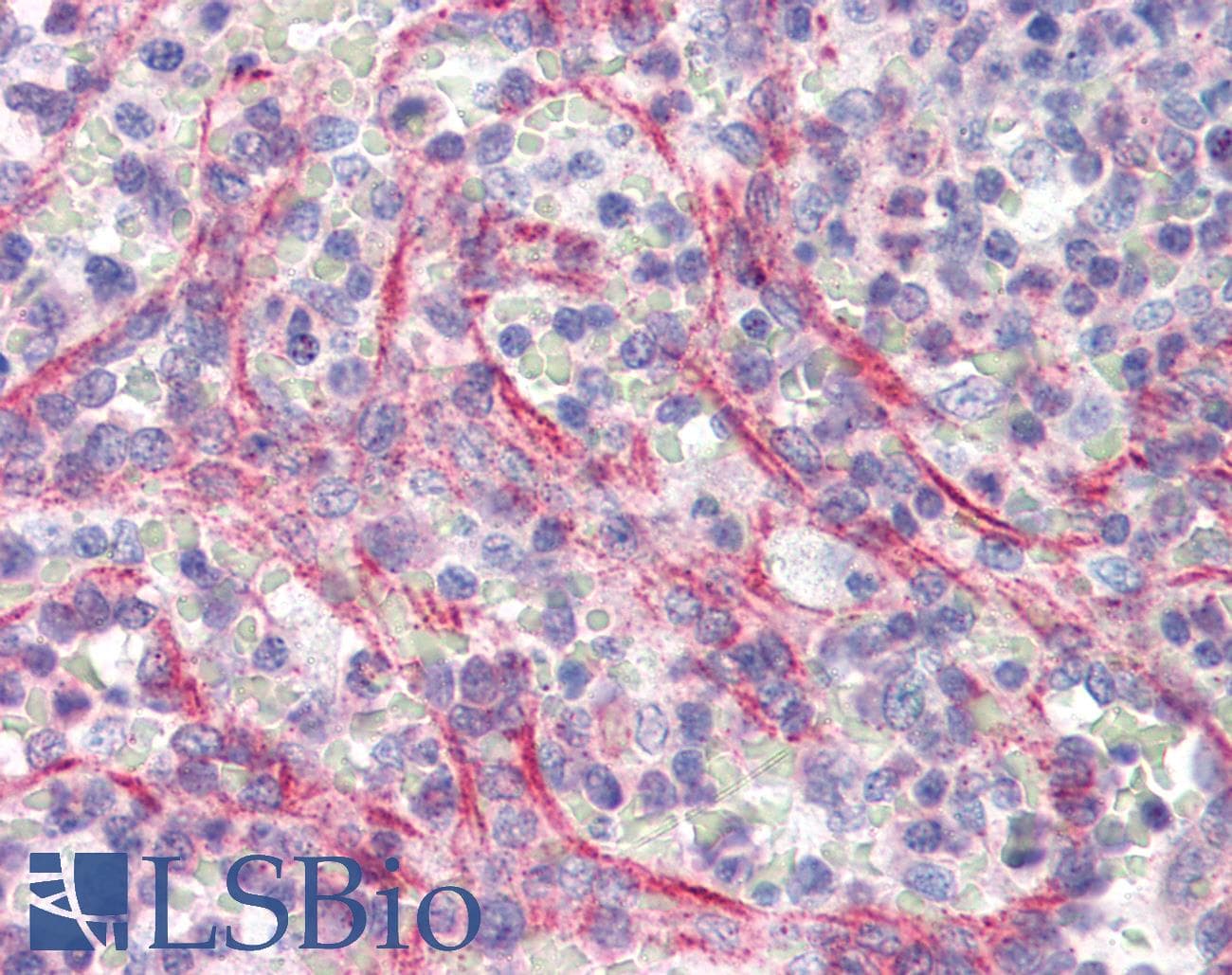 IHC-plus™ SLC29A1 / ENT1 Antibody (aa234-263)