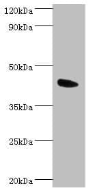 ANGPTL4 Antibody (aa26-406)