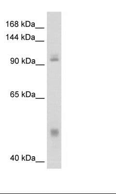 Polyclonal Rabbit anti-Human NFKB1 / NF-Kappa-B Antibody (N-Terminus, IHC, WB)