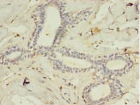 ACSL4 / FACL4 Antibody