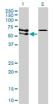 ACVRL1 Antibody (clone 5B1)